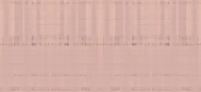 Horizontal Pattern