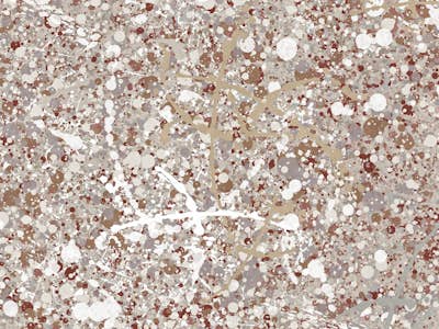 Τοιχογραφία